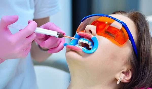 Biolase Whitening Image 2