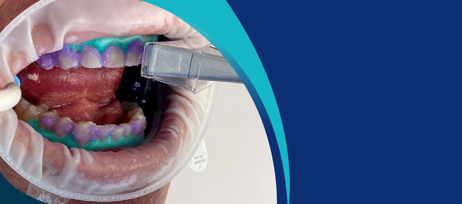 Biolase Whitening Background