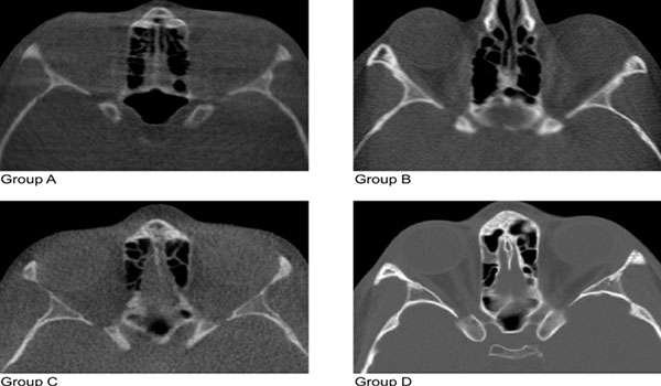 CBCT Scan Image 1