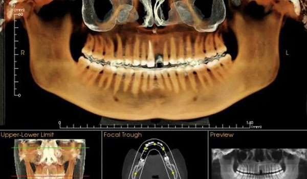 CBCT 3D Imaging 2