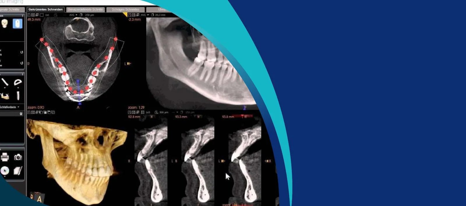 CBCT Background