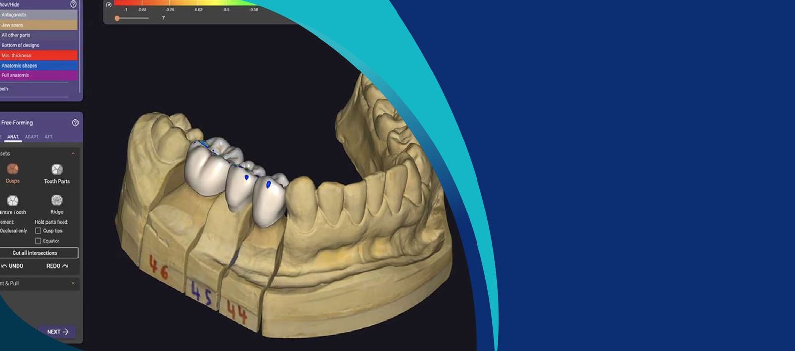 Exocad Software Background