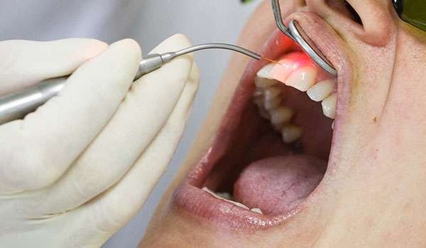 Lasers Hard and Soft Tissues Image 2